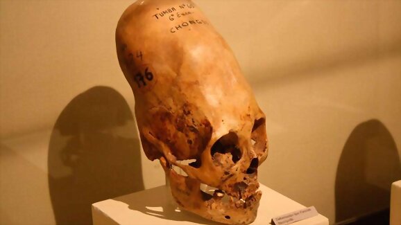 Los cráneos de Paracas